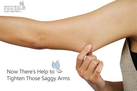 burberry arm|How To Tighten Burberry Arms .